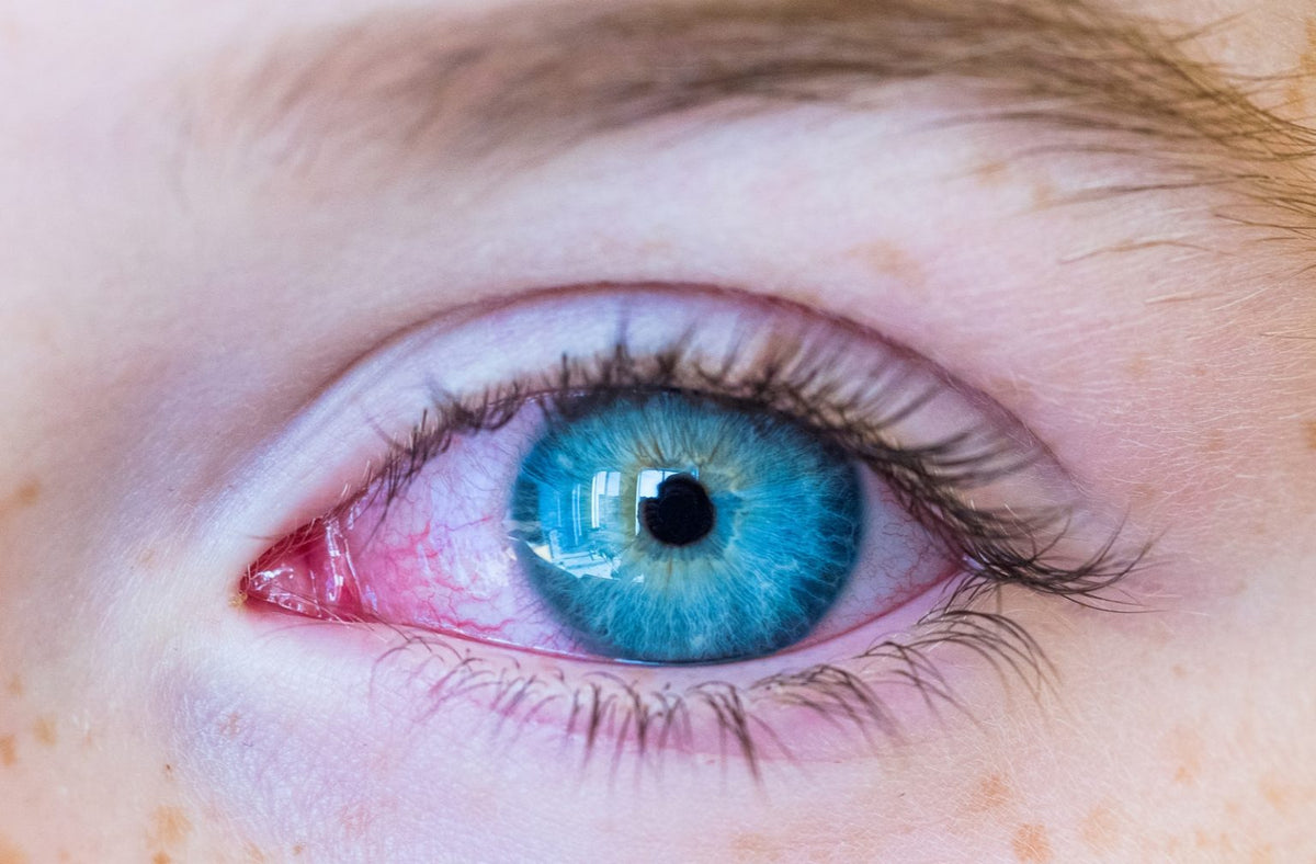 CONMENT ÉVITER LES YEUX ROUGES – Star Lashes World
