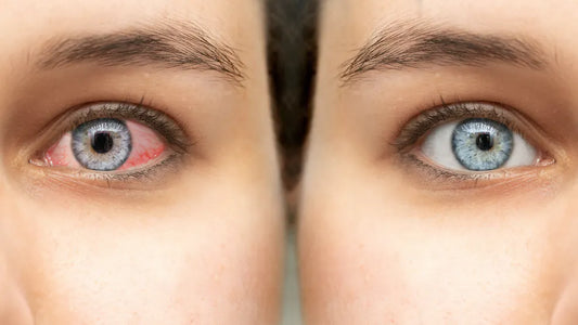 COMMENT TRAVAILLER AVEC DES CLIENTS AUX YEUX SENSIBLES ﻿